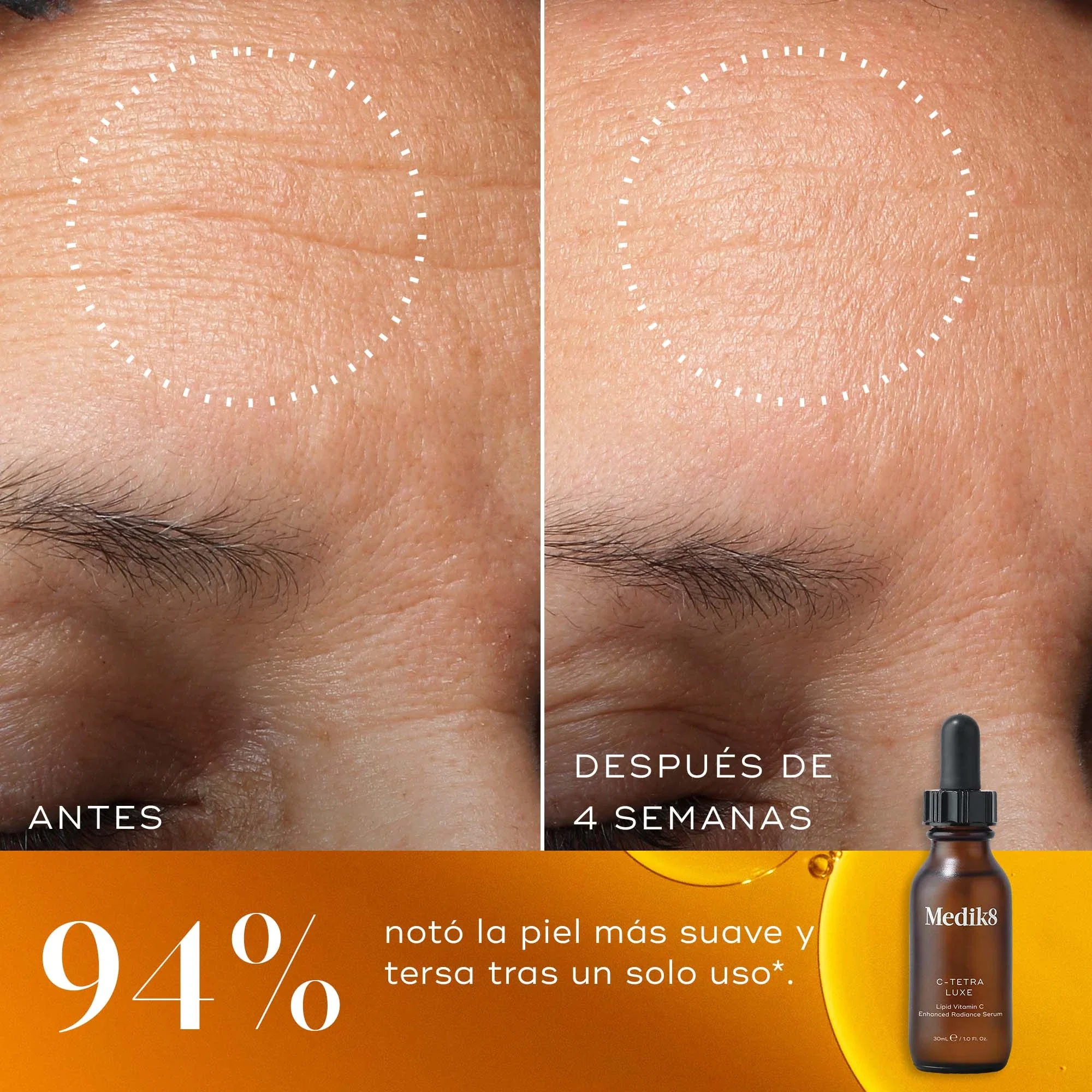 C-Tetra® Luxe - Image 3